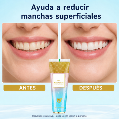 NiaSmile™ – Pasta Dental Blanqueadora con Niacinamida 120 g